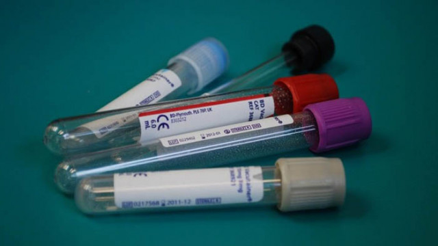 Двама български спортисти с положителни допинг тестове